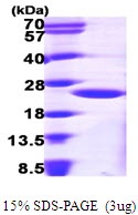 Human ADP-Ribosylation Factor 1 (ARF1)