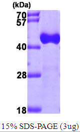 Human ACAA1