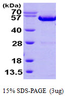 Human Annexin A11 (ANXA11)