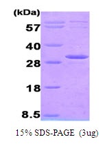 Human Adenylate Kinase 4 (AK 4)