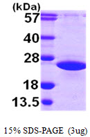 Human ADP-Ribosylation Factor-like Protein 2 (ARL2)