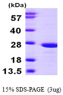 Human ATP Synthase Subunit O, Mitochondrial (ATP5O)