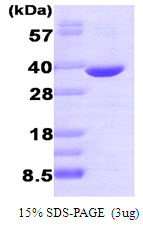 Human Aldose Reductase (AR)