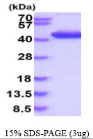Human Aldolase C