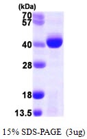 Human alpha-Ketoglutarate-dependent Dioxygenase AlkB Homolog 3 (ALKBH3)