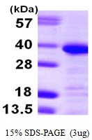 Human Annexin A13  (ANXA13)