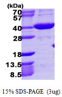 Human AKR1C4