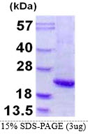 Human alpha-1-Acid-Glycoprotein (Orosomucoid, AGP)
