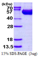 Human Argininosuccinate Lyase (ASL)