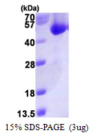 Human Acyl-CoA Thioesterase 7 (ACOT7)
