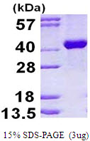 Human Aldolase B