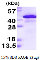 Human Alcohol Dehydrogenase 1A (ADH1A)