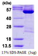 Human Aspartyl-tRNA Synthetase (AspRS, DARS)