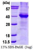 Human Amyloid Precursor Protein (APP)