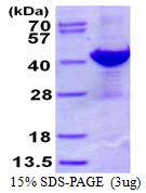 Human ADPRH