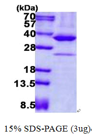 Human AMPK beta 2