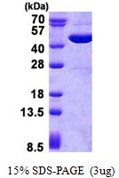 Human Aspartate Aminotransferase -Mitochondrial (mAspAT, GOT2)