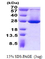 Human ADI1