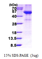 Human Fetuin-A (AHSG)