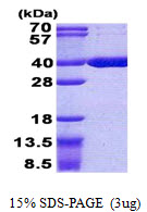 Human Acyl-coenzyme A Thioesterase 8