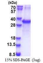 Human Acyl-CoA Thioesterase 11 (ACOT11)