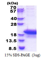 Human cAMP-Regulated Phosphoprotein 19 (ARP19)