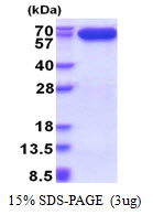 Human Apoptosis-Inducing Factor 1 (AIF)