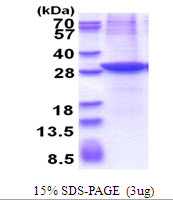 Human ASAM