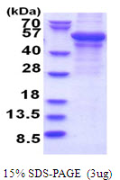 Human Perilipin 2 (PLIN2, ADFP)