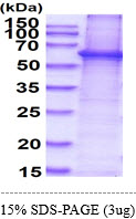 Human AKT1