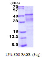 Human ACP2