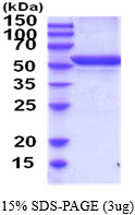Rat Alanine Transaminase (GPT1)