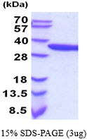 Human alpha-Actinin-1 (ACTN1)