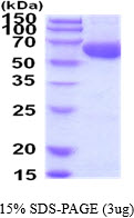 Human Acyl-CoA Synthetase Family Member 2 (ACSF2)