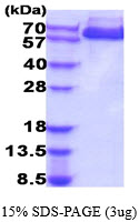 Human alpha-Fetoprotein (AFP)