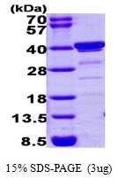 Human Biliverdin Reductase A (BLVR A)