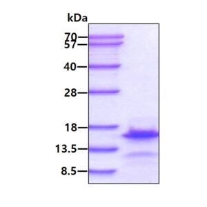 Human Brain Natriuretic Peptide (BNP)