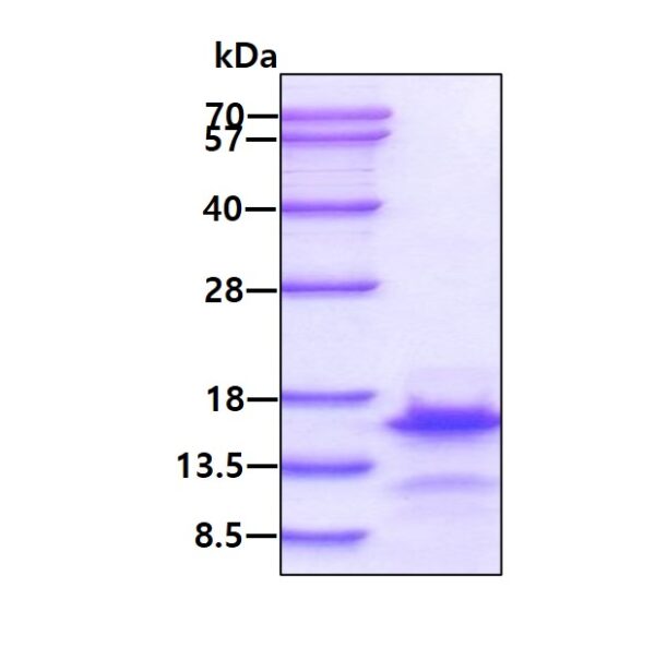 Human Brain Natriuretic Peptide (BNP)