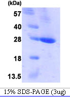 Human Bcl-2