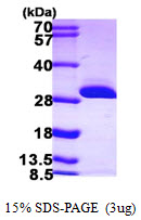 Human BDH2