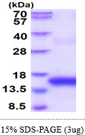 Human BCMA