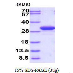 Human beta B1 Crystallin