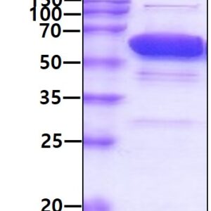 Human Catalase