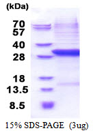 Human Complement Factor B