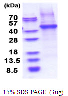 Human CD14