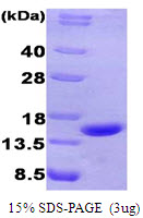 Human Chromogranin A