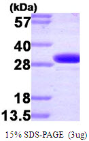 Human Carbonic Anhydrase 2 (CA2)