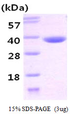 Human Carbonyl Reductase 3 (CBR3)