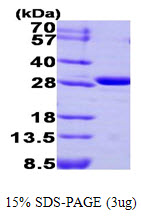 Human Carbonic Anhydrase 3 (CA3)
