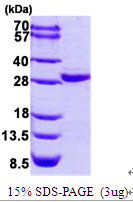 Human COL4A3BP